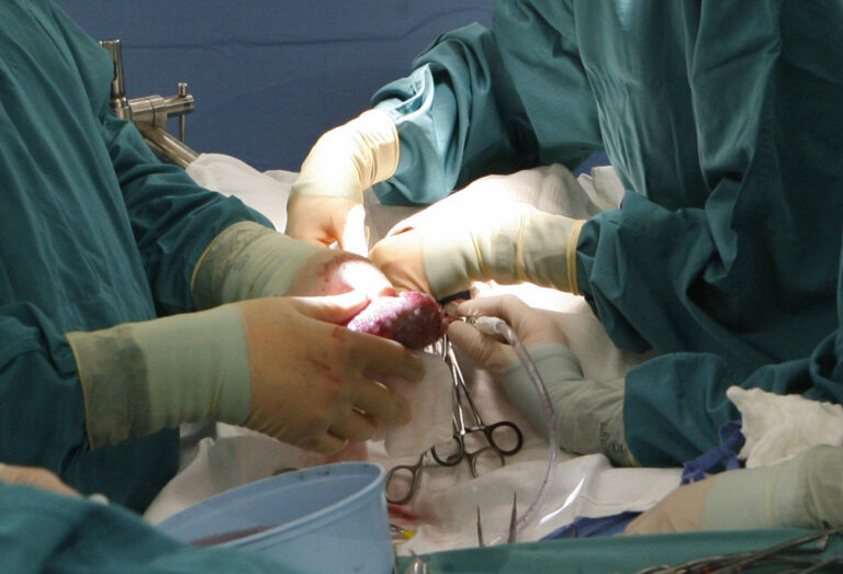 Die Transplantation einer Niere, aufgenommen am 3. April 2007 in einem Krankenhaus in Salt Lake City, USA. Die Bereitschaft der Bundesbuerger zu Organspenden waechst. Aber das Angebot reicht bei weitem nicht aus. Jedes Jahr sterben rund 1.000 Menschen, die vergeblich auf ein Organ warten. Rund 12.000 Menschen warten in Deutschland auf ein neues Organ - eine Niere, eine Leber, ein Herz. Viele von ihnen hoffen vergebens, wie Experten anlaesslich des Tages der Organspende am 7. Juni 2008 beklagen. (AP Photo/Al Hartmann, Pool) --- The transplant of a kidney is seen in this April 3, 2007 picture at Primary Children's Medical Center in Salt Lake City. (AP Photo/Al Hartmann, Pool)