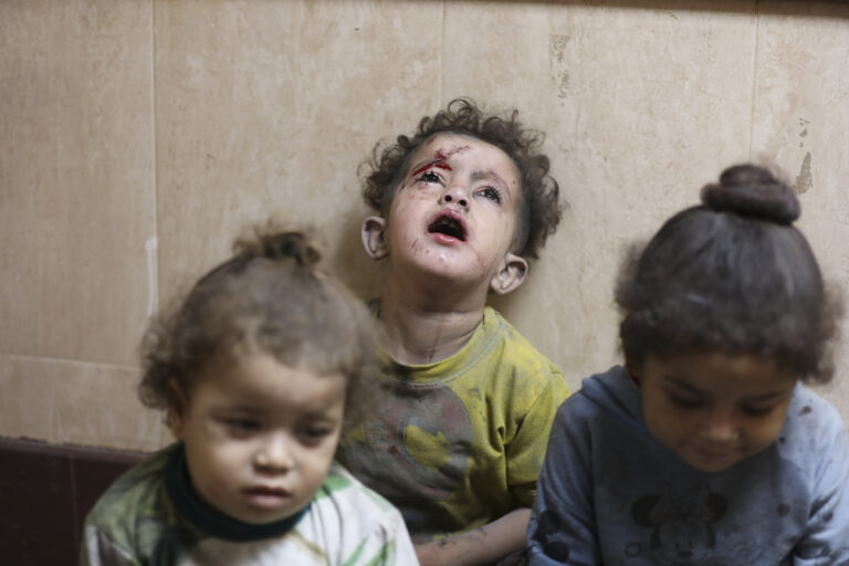 Palestinian children wounded in the Israeli bombardment of the Gaza Strip are treated at al Aqsa Hospital on Deir al Balah, Gaza Strip, Tuesday, Nov. 21, 2023. (AP Photo/Marwan Saleh)